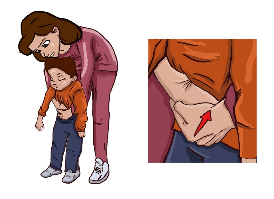 Πνιγμονή παιδί 2