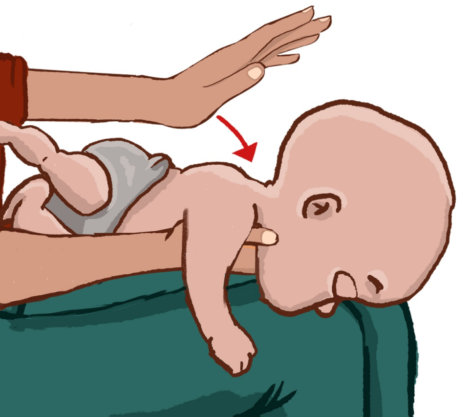 Πνιγμονή βρέφος 2